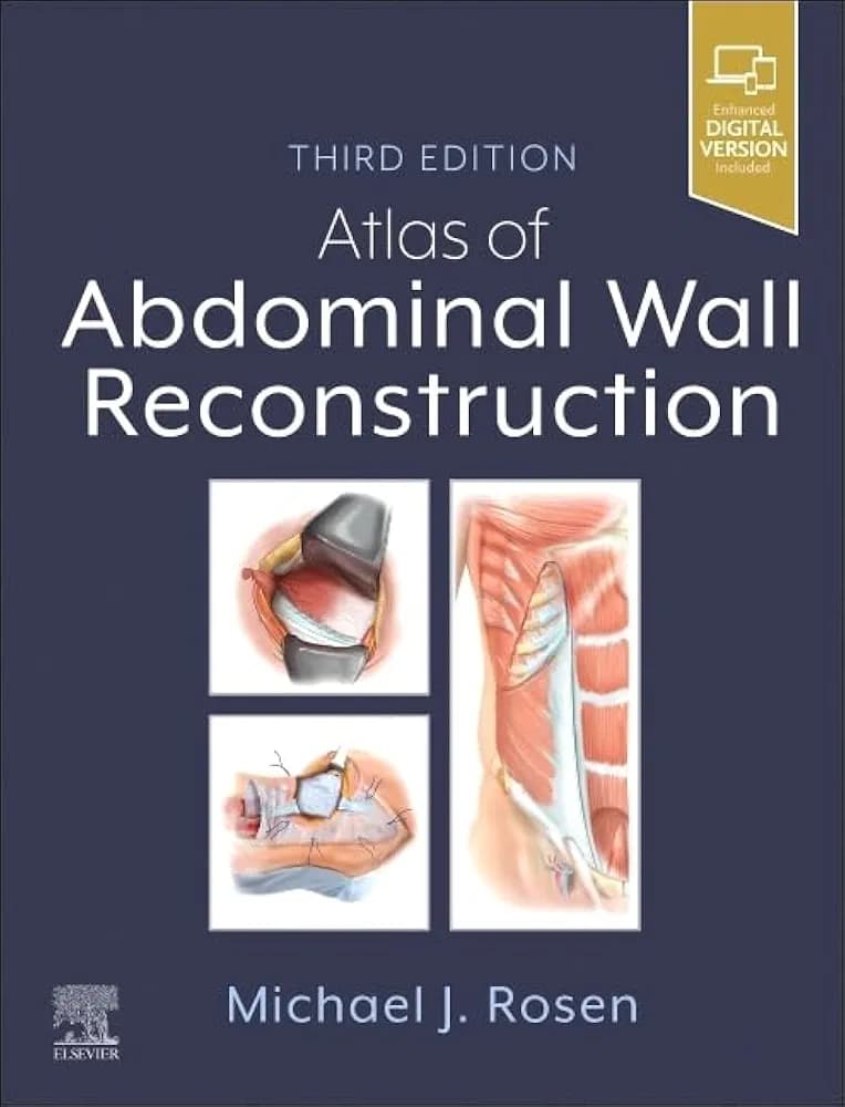 Atlas of Abdominal Wall Reconstruction, 3rd Edition - Editor : Michael J. Rosen