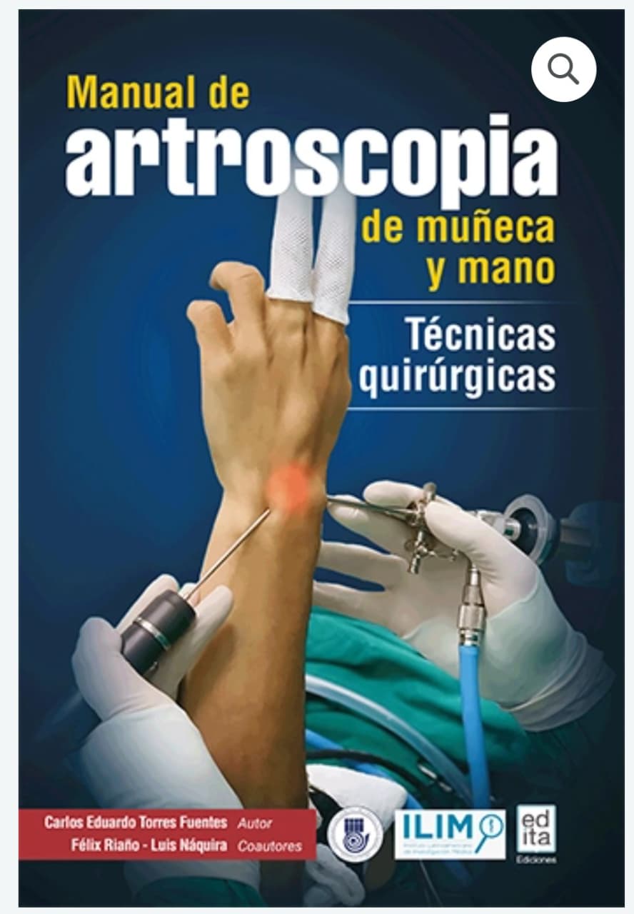 Manual de Artroscopia de muñeca y mano. Tecnicas quirúrgicas - Carlos Eduardo Torres