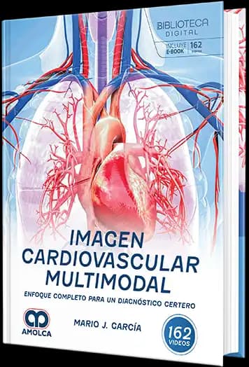Imagen cardiovascular multimodal. Enfoque completo para un diagnóstico certero / Dr. Mario J. García