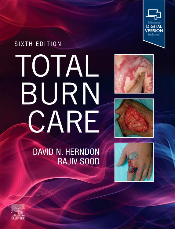 Total Burn Care, 5th Edition Author : David N. Herndon