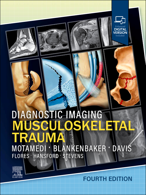 Diagnostic Imaging: Musculoskeletal Trauma, 4th Edition /Authors : Kambiz Motamedi & Donna G. Blankenbaker & Kirkland W. Davis