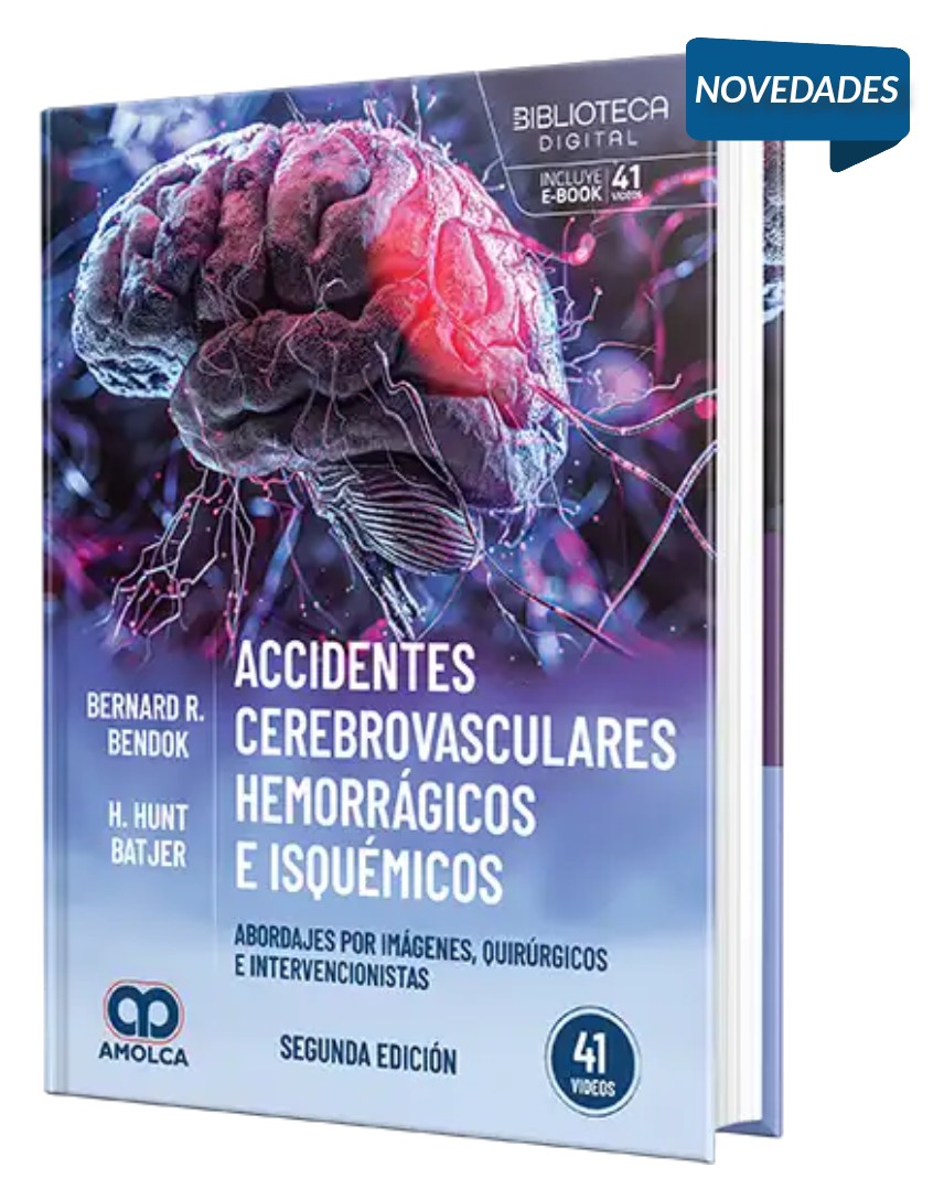 Accidentes cerebrovasculares hemorrágicos e isquémicos. Abordajes por imágenes, quirúrgicos e intervencionistas