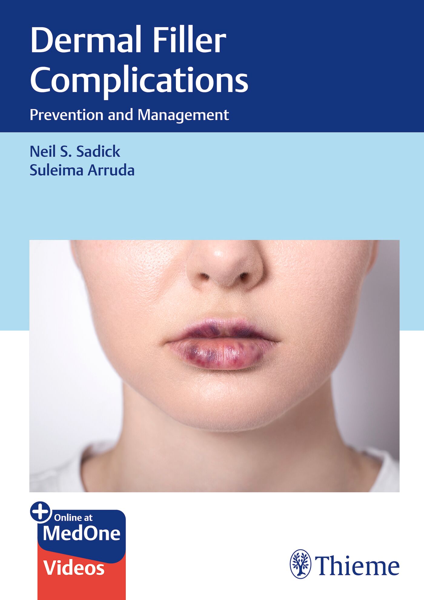 Dermal Filler Complications Prevention and Management / Neil S. Sadick, Suleima Arruda