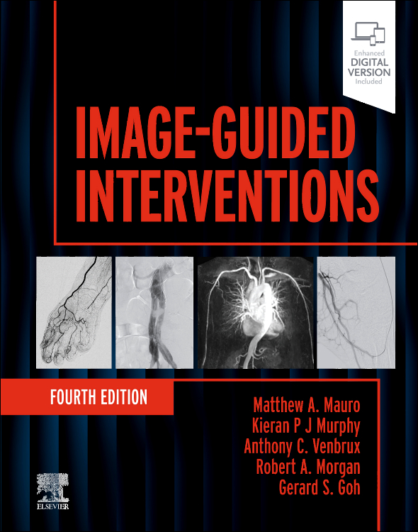 Image-Guided Interventions, 4th Edition /Authors: Matthew A. Mauro,Kieran P.J. Murphy,Anthony C. Venbrux,Robert A. Morgan,Gerard Goh