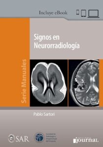 Signos en Neurorradiología 1 Edición /Autores: Pablo Sartori