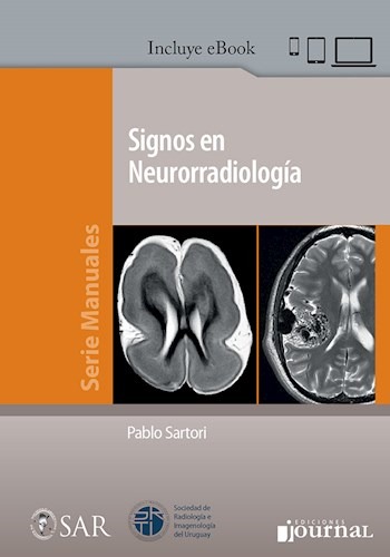 Signos en Neurorradiología 1 Edición /Autores: Pablo Sartori