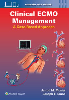 Clinical ECMO Management A Case-Based Approach Edition / Author(s) : Jarrod Mosier MD, PLLC,Joseph Edward Tonna MD