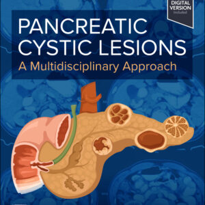 Pancreatic Cystic Lesions: A Multidisciplinary Approach, 1st Edition A Multidisciplinary Approach /Author: Sebastian G. de la Fuente