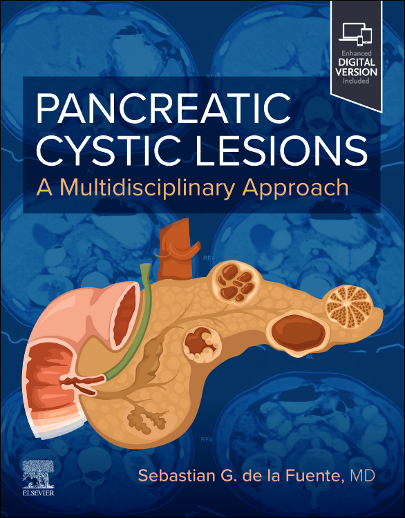 Pancreatic Cystic Lesions: A Multidisciplinary Approach, 1st Edition A Multidisciplinary Approach /Author: Sebastian G. de la Fuente