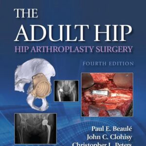 The Adult Hip: Hip Arthroplasty Surgery Edition: 4 / Author(s) : PAUL E. BEAULE MD,Christopher L. Peters ,JOHN C. CLOHISY MD,John Clohisy MD