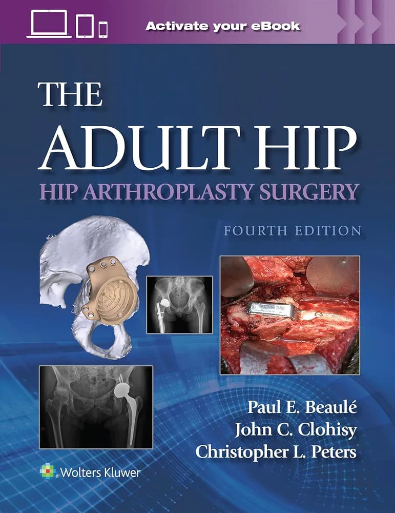 The Adult Hip: Hip Arthroplasty Surgery Edition: 4 / Author(s) : PAUL E. BEAULE MD,Christopher L. Peters ,JOHN C. CLOHISY MD,John Clohisy MD