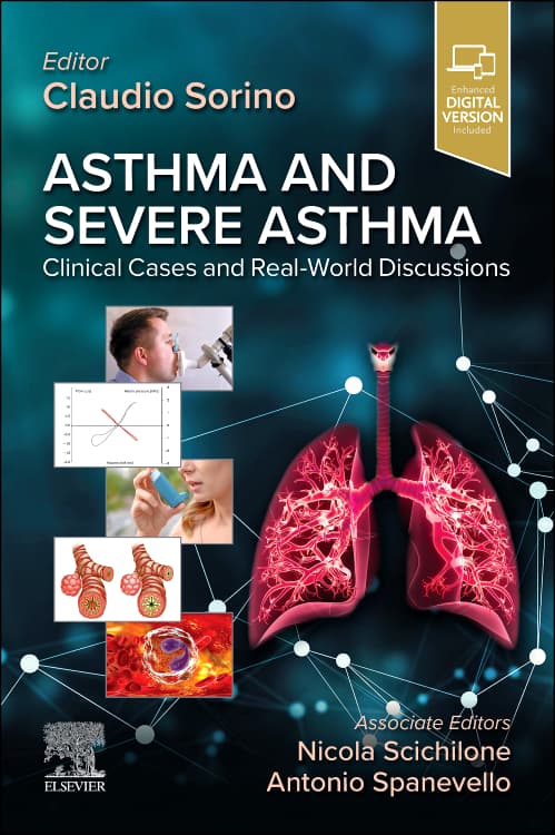 Asthma and Severe Asthma, 1st Edition / Author: Claudio Sorino