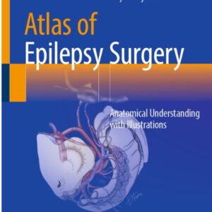 Atlas of Epilepsy Surgery Anatomical Understanding with Illustrations /Authors: Takehiro Uda , Shunsuke Nakae , Daijiro Kojima
