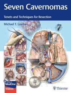 Seven Cavernomas Tenets and Techniques for Resection /Michael T. Lawton