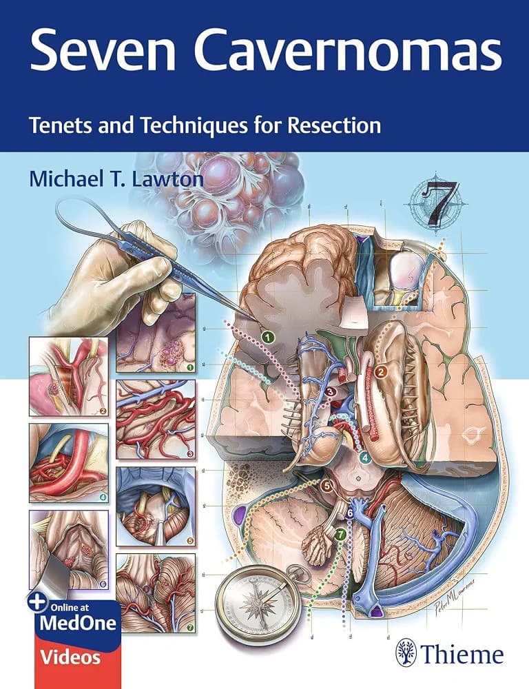 Seven Cavernomas Tenets and Techniques for Resection /Michael T. Lawton